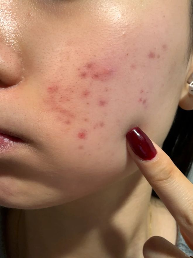 没换了？这种毛巾建议马上换掉AG真人app你家的毛巾多久(图7)